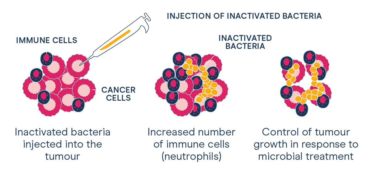 immunotherapy