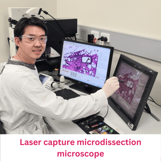 Laser capture microdissection microscope